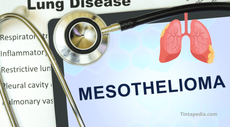 Mesothelioma Lawsuit